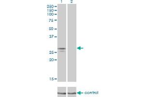 Western blot analysis of NDUFS3 over-expressed 293 cell line, cotransfected with NDUFS3 Validated Chimera RNAi (Lane 2) or non-transfected control (Lane 1). (NDUFS3 antibody  (AA 1-264))
