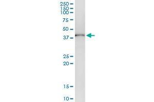 Immunoprecipitation of ADH1C transfected lysate using anti-ADH1C MaxPab rabbit polyclonal antibody and Protein A Magnetic Bead , and immunoblotted with ADH1C purified MaxPab mouse polyclonal antibody (B01P) . (ADH1C antibody  (AA 1-375))