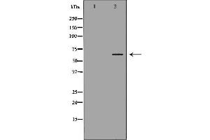Western blot analysis of Jurkat  lysate using STIP1 antibody. (STIP1 antibody  (N-Term))