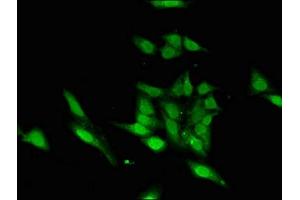 Immunofluorescent analysis of Hela cells using ABIN7155470 at dilution of 1:100 and Alexa Fluor 488-congugated AffiniPure Goat Anti-Rabbit IgG(H+L) (ASH1L antibody  (AA 1906-2160))