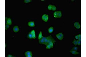 Immunofluorescent analysis of PC-3 cells using ABIN7143089 at dilution of 1:100 and Alexa Fluor 488-congugated AffiniPure Goat Anti-Rabbit IgG(H+L)