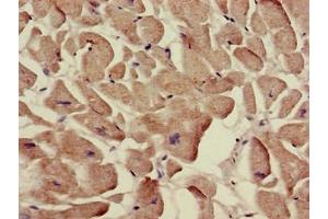 Immunohistochemistry of paraffin-embedded human heart tissue using ABIN7170088 at dilution of 1:100 (SLC12A7 antibody  (AA 11-117))