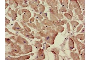 Immunohistochemistry of paraffin-embedded human heart tissue using ABIN7170088 at dilution of 1:100