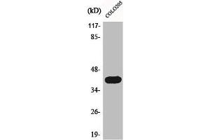 Western Blot analysis of COLO205 cells using Actin α3 Polyclonal Antibody (ACTG2 antibody  (N-Term))