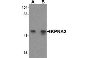 Western blot analysis of KPNA2 in rat heart tissue lysate with KPNA2 antibody at (A) 1 and (B) 2 μg/ml.
