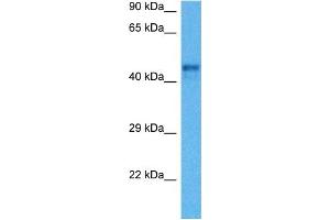 Host:  Mouse  Target Name:  REN1  Sample Tissue:  Mouse Heart  Antibody Dilution:  1ug/ml (Renin antibody  (C-Term))
