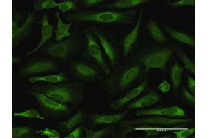 Immunofluorescence of purified MaxPab antibody to NARS on HeLa cell. (NARS antibody  (AA 1-548))