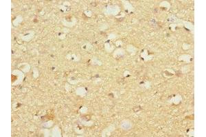 Immunohistochemistry of paraffin-embedded human brain tissue using ABIN7163588 at dilution of 1:100 (GP1BB antibody  (AA 27-147))