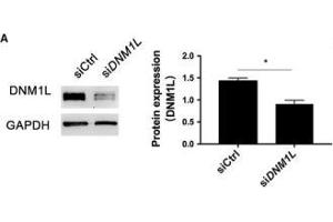 DNM1L deficiency alters mitochondria morphology and mitochondrial membrane potential in FLSs. (GAPDH antibody)