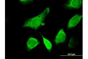 Immunofluorescence of purified MaxPab antibody to GEMIN6 on HeLa cell. (GEMIN6 antibody  (AA 1-167))
