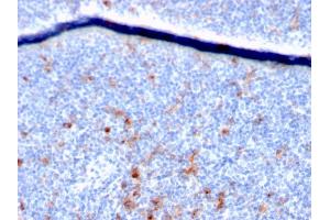 Immunohistochemistry (IHC) image for anti-Interleukin 2 Receptor, alpha (IL2RA) (AA 42-183) antibody (ABIN6939779)