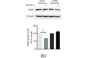 The effects of BoHV-1 infection on the gene expression of antioxidant enzymes. (SOD1 antibody  (AA 1-154))