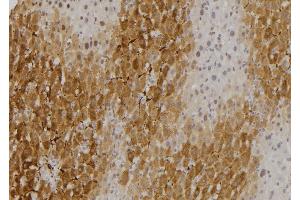 ABIN6275320 at 1/100 staining Rat liver tissue by IHC-P. (NCOA4 antibody  (C-Term))