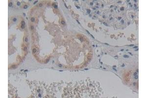 Detection of ABCC8 in Human Kidney Tissue using Polyclonal Antibody to ATP Binding Cassette Transporter C8 (ABCC8) (ABCC8 antibody  (AA 679-929))