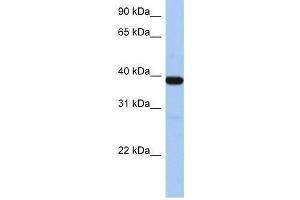 ZNF781 antibody used at 1. (ZNF781 antibody  (N-Term))