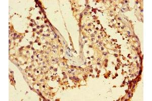 Immunohistochemistry of paraffin-embedded human testis tissue using ABIN7158030 at dilution of 1:100 (LZTFL1 antibody  (AA 116-299))