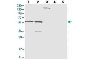 Western blot analysis of Lane 1: RT-4, Lane 2: U-251 MG, Lane 3: Human Plasma, Lane 4: Liver, Lane 5: Tonsil with ZNF250 polyclonal antibody  at 1:250-1:500 dilution. (ZNF250 antibody)