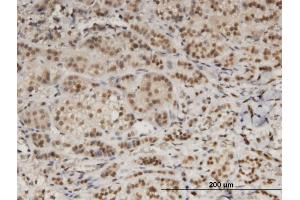 Immunoperoxidase of monoclonal antibody to DDB1 on formalin-fixed paraffin-embedded human adrenal gland. (DDB1 antibody  (AA 1044-1140))