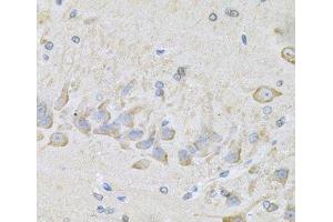 Immunohistochemistry of paraffin-embedded Mouse brain using RhoA Polyclonal Antibody at dilution of 1:100 (40x lens). (RHOA antibody)