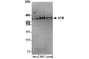Western Blotting (WB) image for anti-Ataxia Telangiectasia Mutated (ATM) (AA 2550-2600) antibody (ABIN7451651)