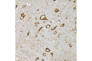 Immunohistochemistry of paraffin-embedded mouse brain using [KO Validated] PHD2 Rabbit pAb (ABIN7266909) at dilution of 1:150 (40x lens). (EGLN1 antibody  (AA 1-426))