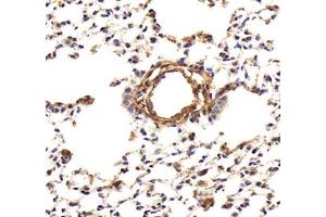 Immunohistochemistry (Paraffin-embedded Sections) (IHC (p)) image for anti-Microfibrillar-Associated Protein 4 (MFAP4) antibody (ABIN7074614)