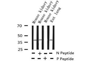 Western blot analysis of Phospho-c-Jun (Ser73) expression in various lysates (C-JUN antibody  (pSer73))