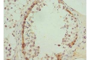 Immunohistochemistry of paraffin-embedded human testis tissue using ABIN7144880 at dilution of 1:100 (ABCA3 antibody  (AA 43-203))
