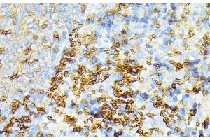 Immunohistochemistry of paraffin-embedded Rat spleen using SPTA1 Polyclonal Antibody at dilution of 1:100 (40x lens). (SPTA1 antibody)