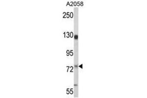 Western blot analysis of MCAM Antibody (MCAM antibody  (Middle Region))