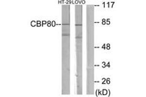 Western blot analysis of extracts from HT-29/LOVO cells, using NCBP1 Antibody.