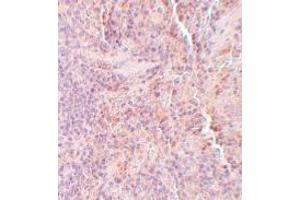 Immunohistochemistry (IHC) image for anti-Sequestosome 1 (SQSTM1) (C-Term) antibody (ABIN1030699) (SQSTM1 antibody  (C-Term))