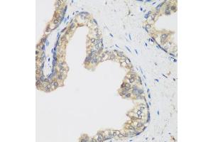 Immunohistochemistry of paraffin-embedded human prostate using NCBP2 antibody (ABIN5974395) at dilution of 1/200 (40x lens). (NCBP2 antibody)