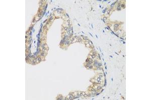 Immunohistochemistry of paraffin-embedded human prostate using NCBP2 antibody (ABIN5974395) at dilution of 1/200 (40x lens).