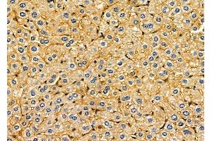 ABIN6261392 and ABIN6279339 at 1/100 staining mouse liver tissue by IHC-P.