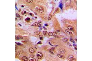 Immunohistochemistry (IHC) image for anti-Tumor Protein P53 (TP53) (acLys386), (C-Term) antibody (ABIN7300198)