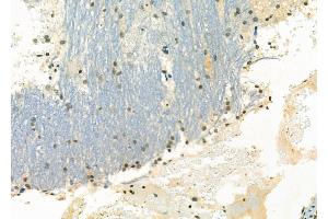 ABIN6263648 and ABIN6266600 at 1/100 staining Rat brain tissue by IHC-P. (NKX3-1 antibody  (Internal Region))