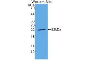 Detection of Recombinant IL18, Bovine using Polyclonal Antibody to Interleukin 18 (IL18) (IL-18 antibody  (AA 37-193))