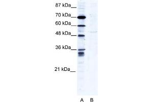 WB Suggested Anti-ZNF134 Antibody Titration:  2. (ZNF134 antibody  (N-Term))