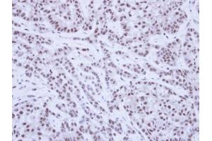 IHC-P Image Immunohistochemical analysis of paraffin-embedded A549 Xenograft, using SAE1, antibody at 1:100 dilution. (SAE1 antibody)