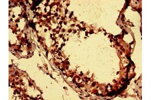 Immunohistochemistry analysis of human testis tissue using ABIN7145123 at dilution of 1:100 (Axin antibody  (AA 418-707))