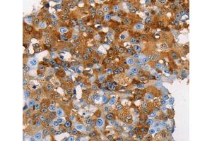 Immunohistochemistry (IHC) image for anti-Mucin 5 Subtype B (MUC5B) antibody (ABIN2432113) (MUC5B antibody)