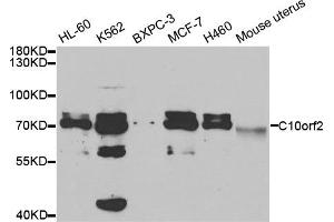 Western Blotting (WB) image for anti-Chromosome 10 Open Reading Frame 2 (C10ORF2) antibody (ABIN1876491) (C10orf2 antibody)