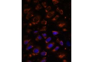 Immunofluorescence analysis of U-2 OS cells using TENM1 antibody (ABIN7270767) at dilution of 1:100. (ODZ1/Teneurin 1 antibody  (AA 350-540))