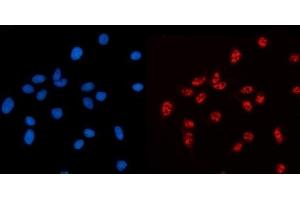 IF analysis of AKAP 95/AKAP8 using anti-AKAP 95/AKAP8 antibody (ABIN7601553). (AKAP8 antibody  (AA 380-546))