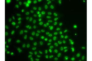 Immunofluorescence analysis of U2OS cells using TOX antibody (ABIN5974241).