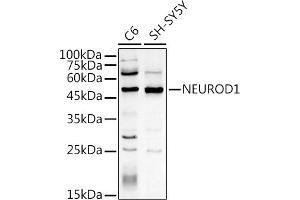 Western blot analysis of extracts of various cell lines, using NEUROD1 antibody (ABIN3021547, ABIN3021548, ABIN3021549, ABIN1513255 and ABIN6215228) at 1:500 dilution.