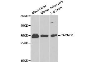 Western blot analysis of extracts of various cell lines, using CACNG4 antibody (ABIN5974747) at 1/1000 dilution. (CACNG4 antibody)