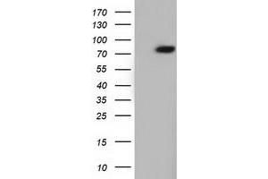 Western Blotting (WB) image for anti-rho GTPase Activating Protein 25 (ARHGAP25) antibody (ABIN1496709) (ARHGAP25 antibody)