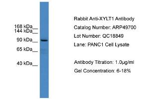 WB Suggested Anti-XYLT1  Antibody Titration: 0.